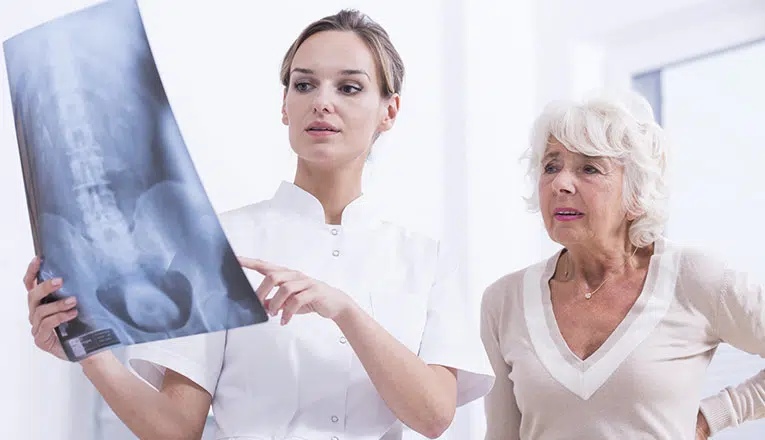 un médecin montre une IRM à une femme qui se plaint d'arthrose du dos.