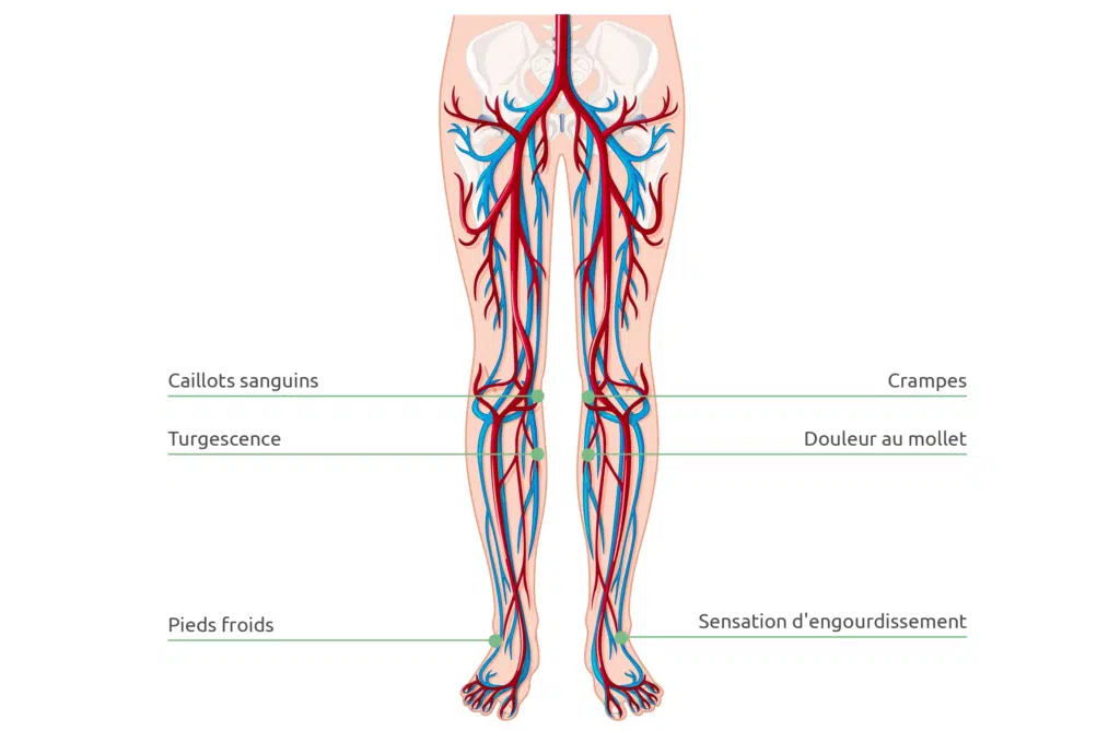 Représentation schématique de la circulation sanguine dans les jambes. Une mauvaise circulation provoque des jambes fatiguées.